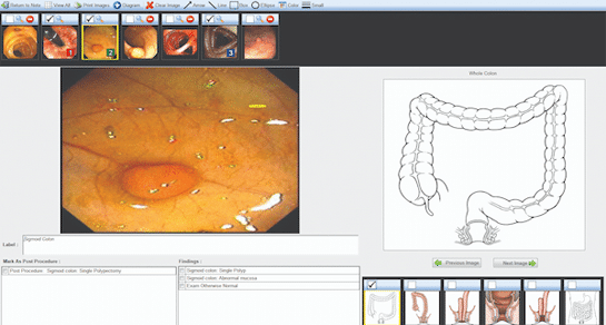 On-premises gastroenterology software