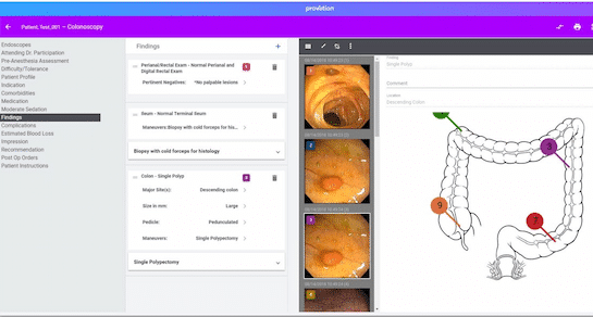 Cloud-based endoscopy software