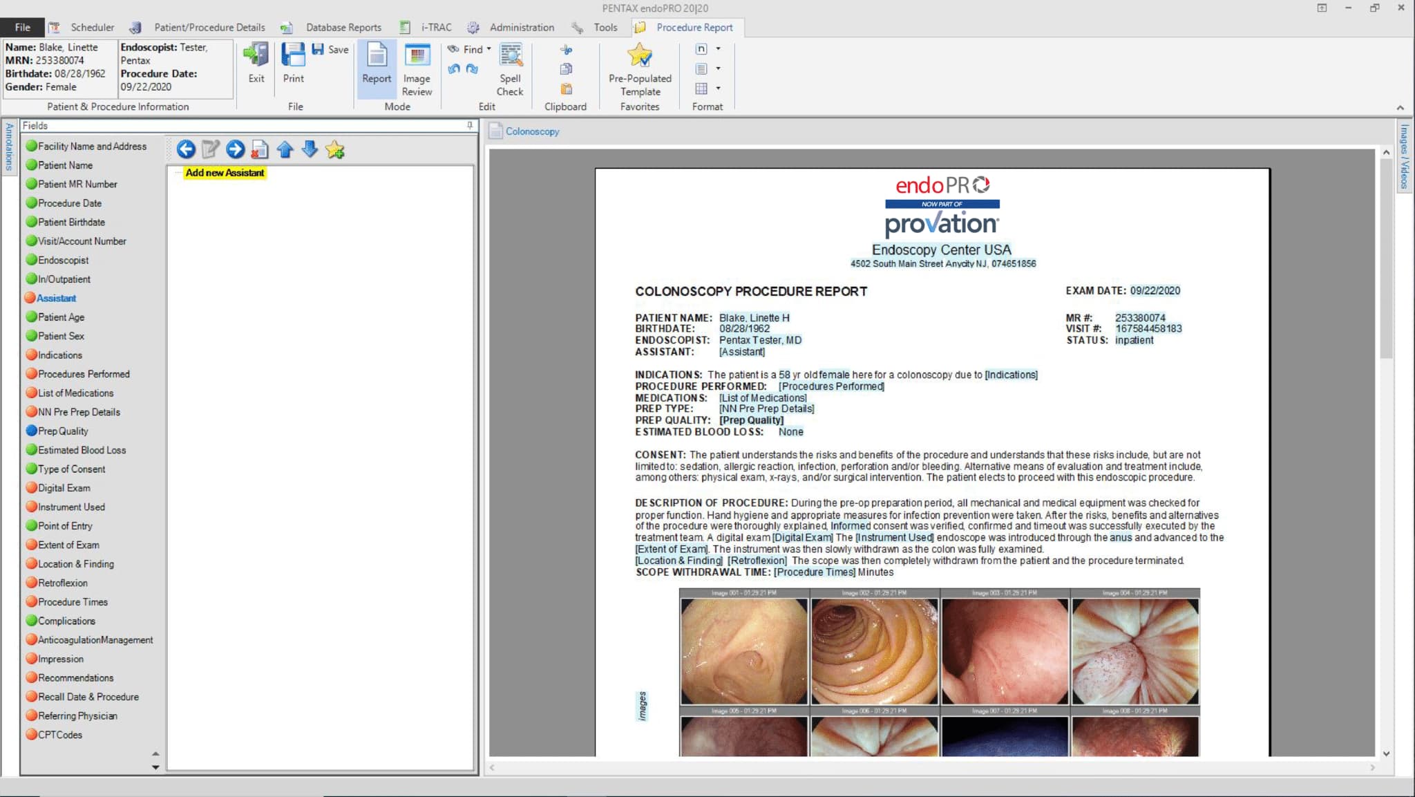 Provation endoPRO Procedure Report