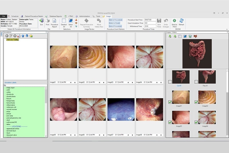Provation endoPRO 20|20 Image Capture Screen