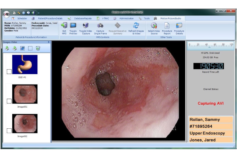 Global_IT_PRO-P_endoPROiQ_colon-(800x533)