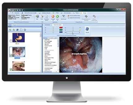 Provation endoPRO iQ Annotation View