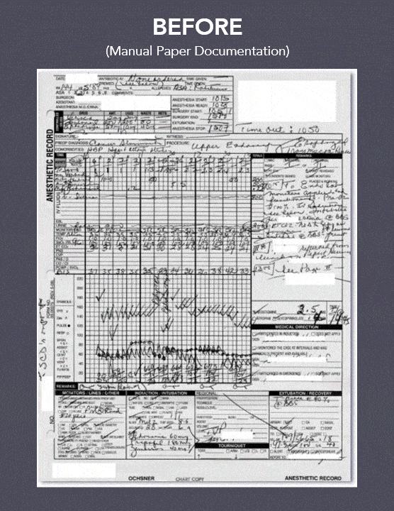 Example of paper-based anesthesia documentation in comparison to iPro documentation