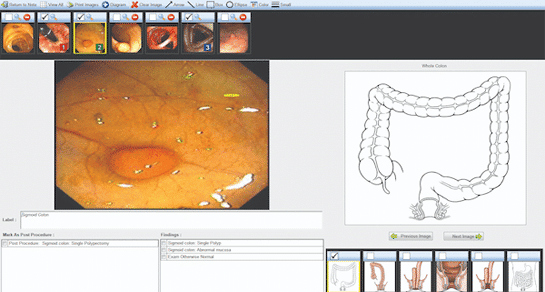 On-premises endoscopy software