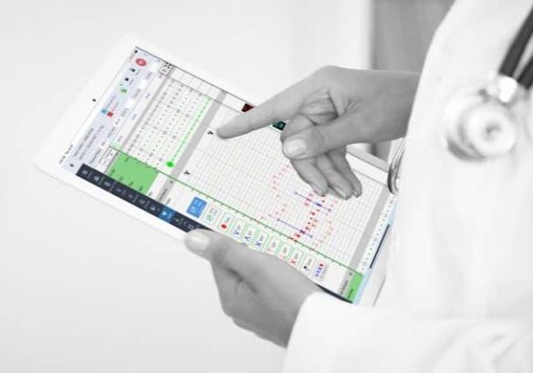 AIMS Anesthesia software featuring the vitals chart functionality, with Provation iPro