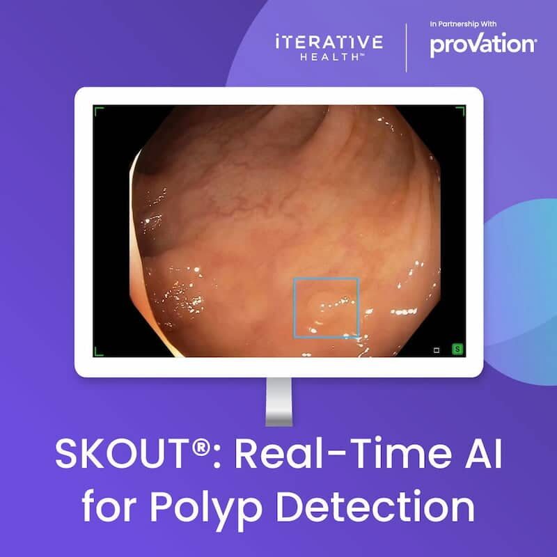 SKOUT: Real-Time AI for Polyp Detection